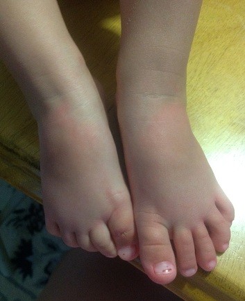 lip gloss on toddler feet