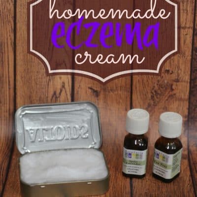 Homemade Eczema Cream Recipe