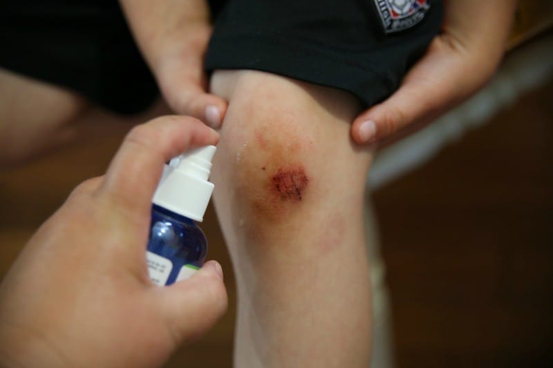 Puracyn-knee-scrape