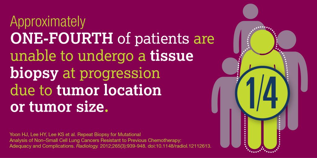 lung-cancer-biopsy