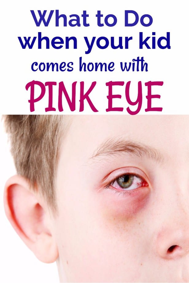 What to do when your kid has pink eye - what to do when your kid comes home with conjunctivitis- homeopathic remedy for pinkeye- homeopathic remedy for conjunctivitis