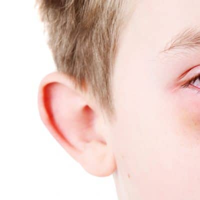 What to Do When Your Kid Gets Pink Eye